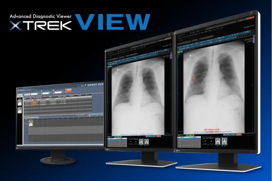 XTREK SeriesにEIRLが搭載されたイメージ