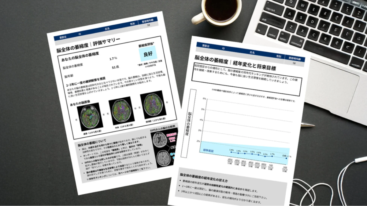 脳の萎縮度評価レポートの例