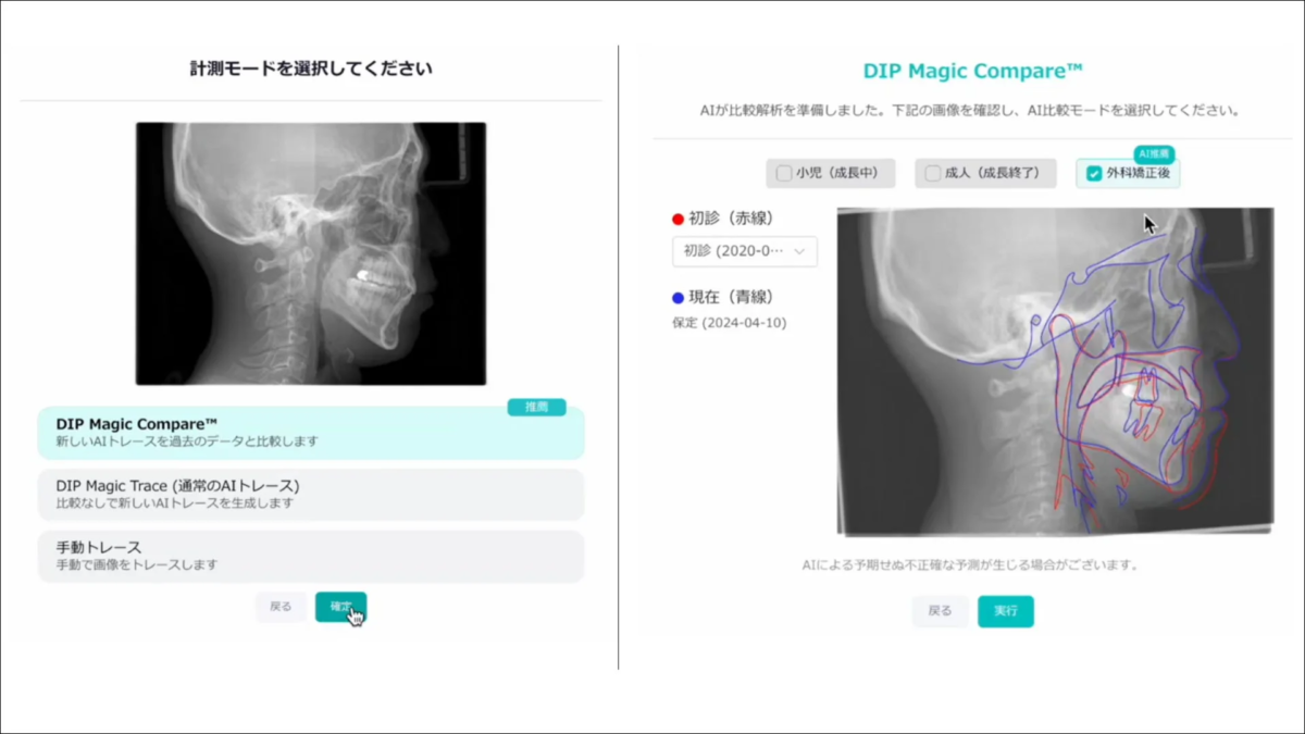 DIP Magic Compare™の機能選択画面
