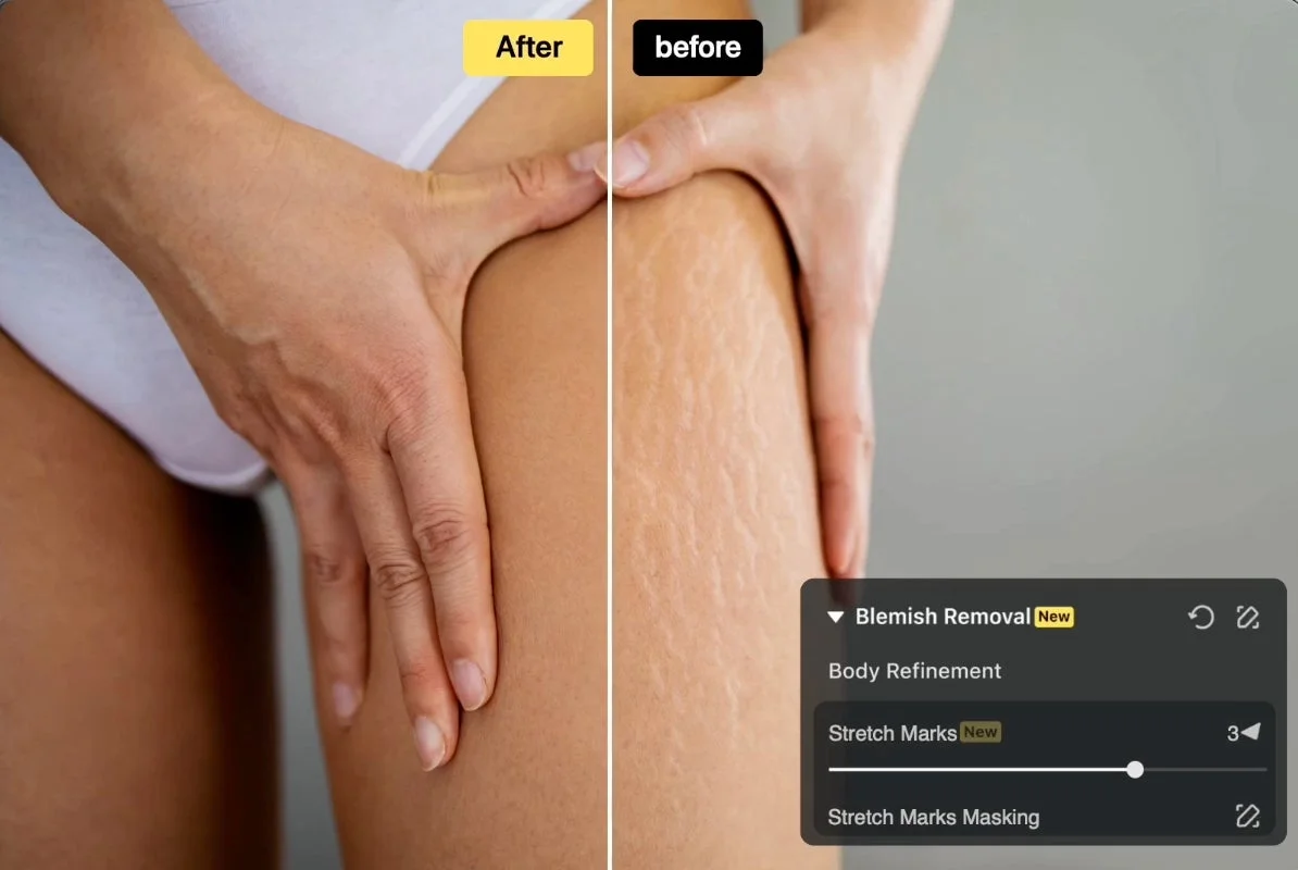 身体の肉割れ除去機能の比較画像