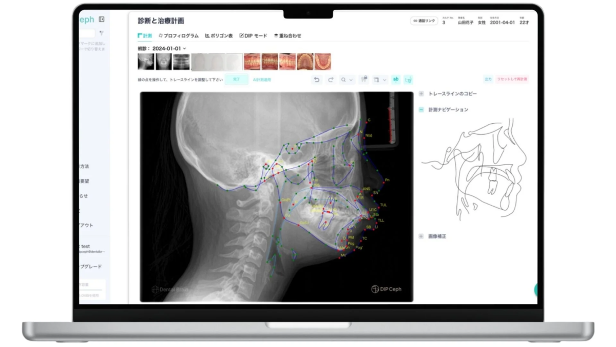 DIP Cephのインターフェース画面