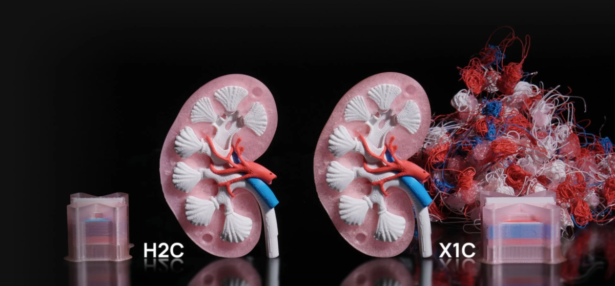 腎臓モデルと廃棄物比較