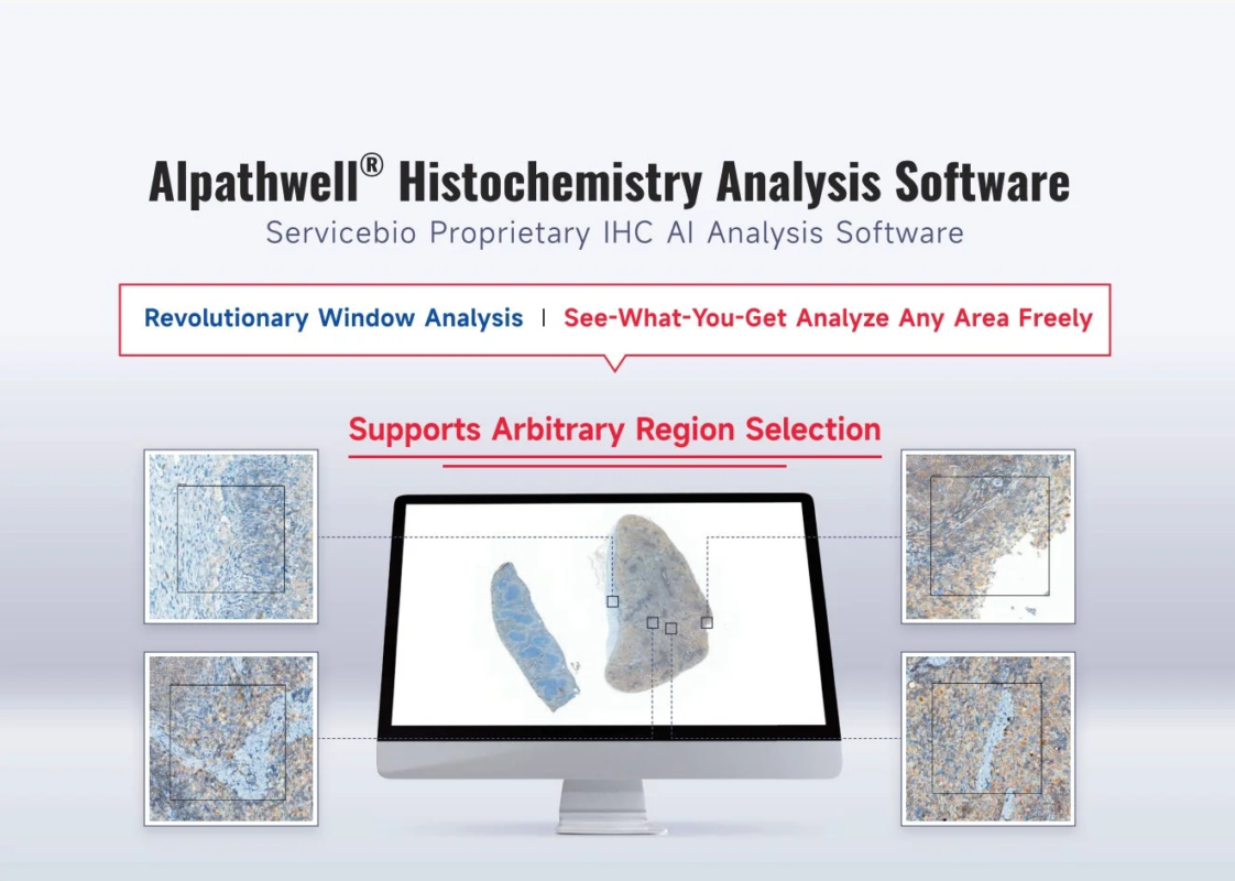 AI解析ソフトウェアの紹介画像