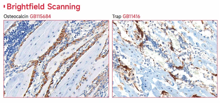 明視野スキャンによる骨組織の画像