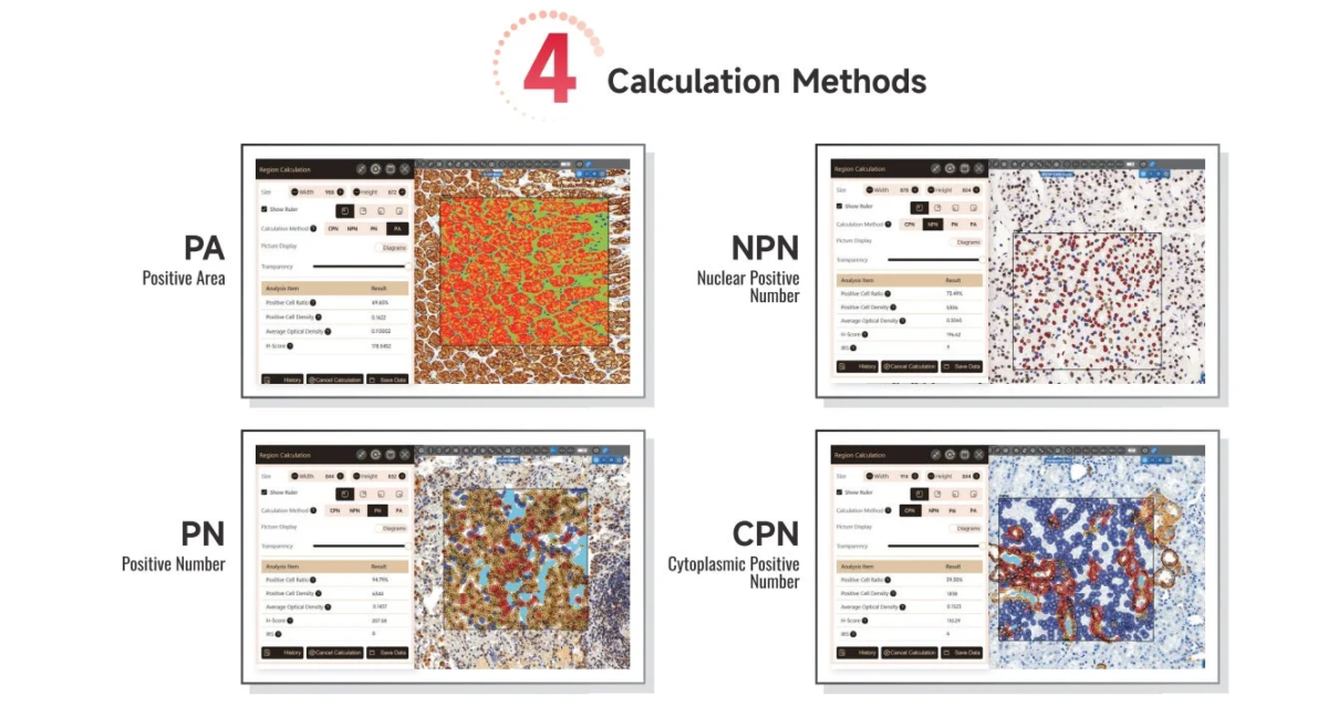 病理解析ソフトウェアの計算方法表示