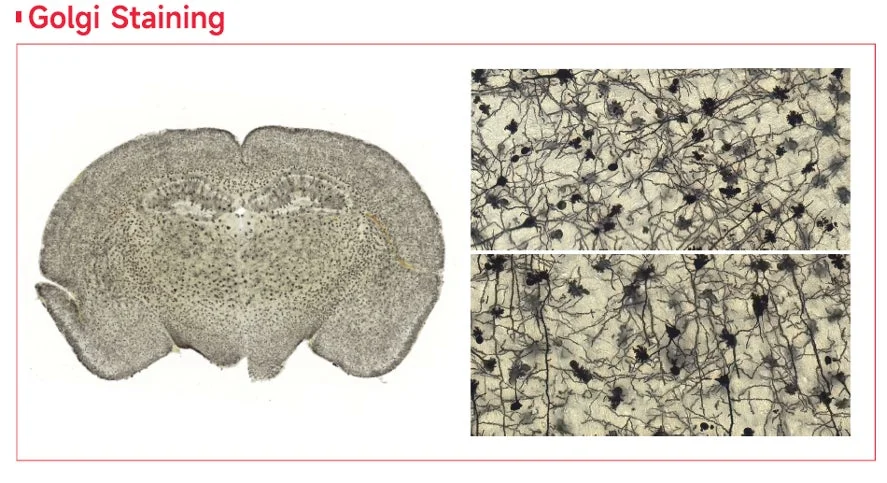 ゴルジ染色された脳組織の画像