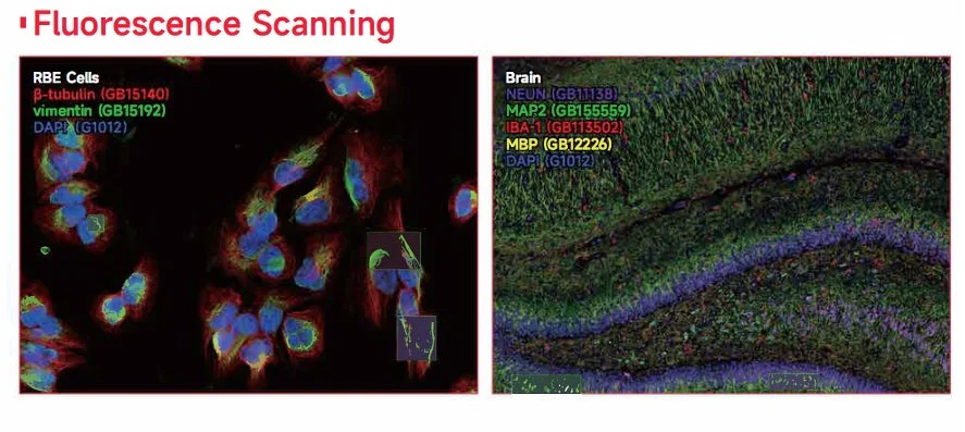蛍光スキャンによるRBE細胞と脳組織の画像